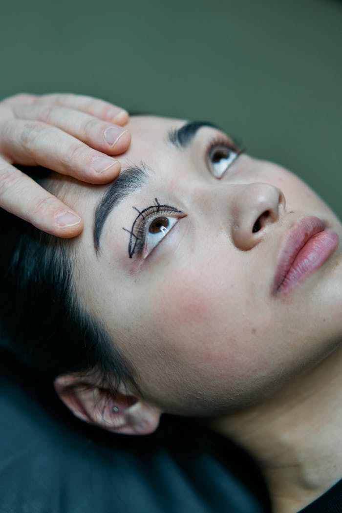 Asian woman with eyelid markings preparing for blepharoplasty.